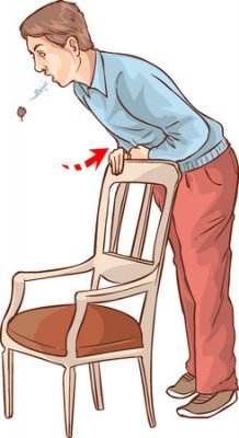 Emergency Medicine: Choking - The Heimlich Maneuver